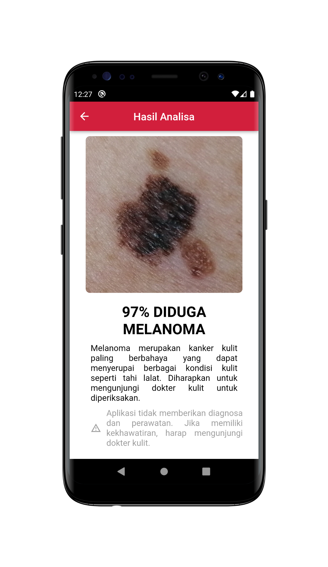 KulitKu - Skin Cancer Detection
